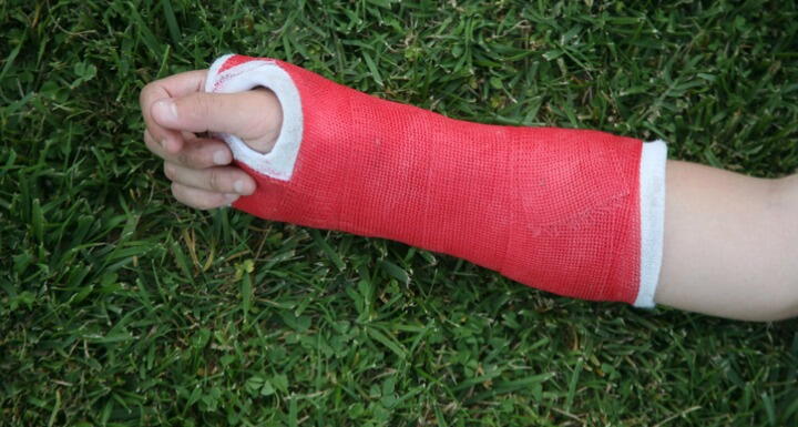 Red wrist arm and hand cast
